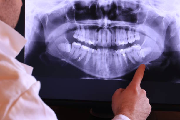 Best Emergency Dental Care for Broken or Chipped Teeth in Ormond Beach, FL